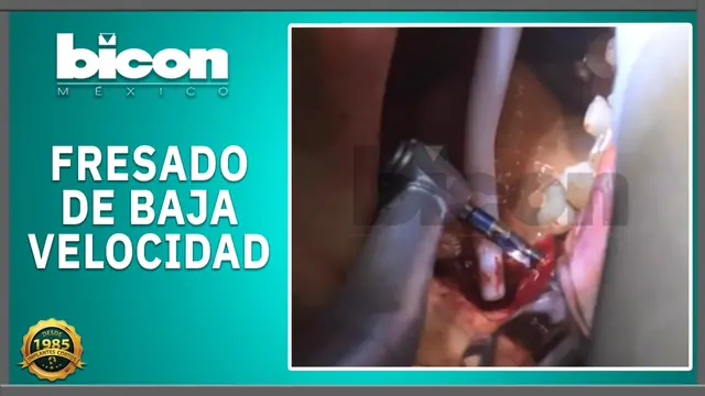 Fresado de baja velocidad